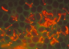 Plasmodium Stained Plasmodium Stained