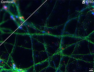 Three-Color STED image Three-color STED image of primary hippocampal neurons imaged with the Abberior<sup>®</sup> Instruments Expert Line STED microscope.