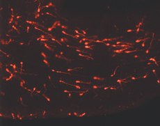 Young Migrating Neurons Labeled Young Migrating Neurons Labeled