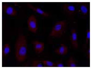 Anti-PGAM2  Anti-PGAM2