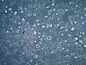 Cell Contamination Cell Contamination