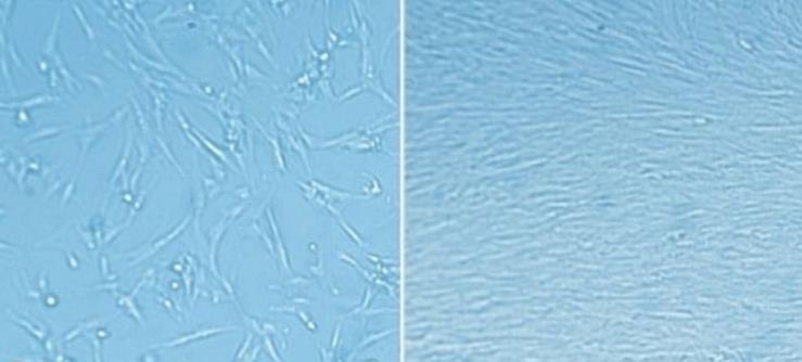 ECM matrix coating enables rapid expansion of fetal lung fibroblasts ECM matrix coating enables rapid expansion of fetal lung fibroblasts