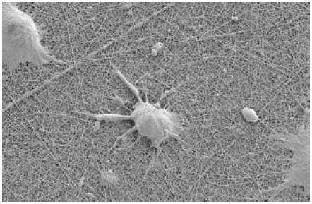 figure3 NG108 neuronal cells growing on an Ultra-Web nanofiber surface
