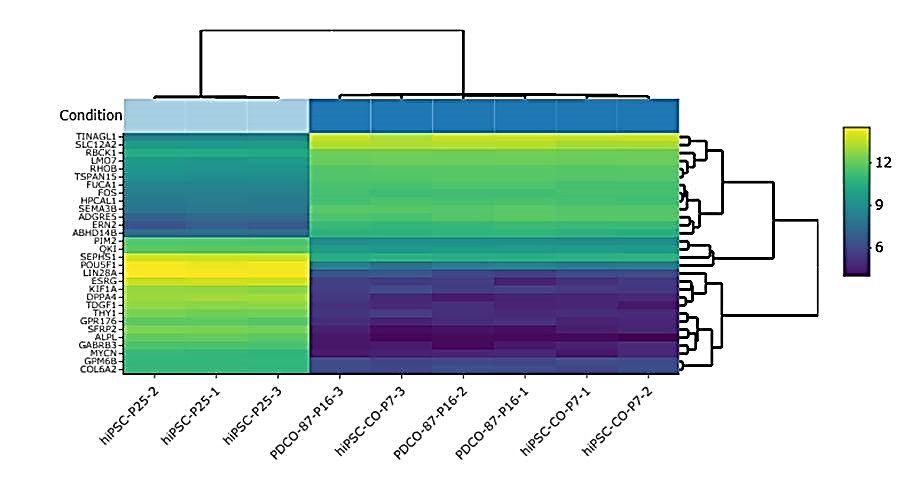 Heatmap of top 30 differentially expressed genes Fig 3: Heatmap of top 30 differentially expressed genes