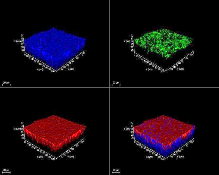 Using Immortalized 16HBE14o- Human Bronchial Epithelial Cell Lines to Model Respiratory Lung Diseases ALI culture of 16HBE14o- human bronchial epithelial cells