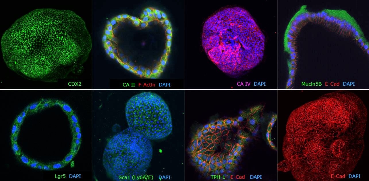 Fig2: Figure 2. Immunocytochemical characterization of human colon organoids (Colon-87, SCC321). Human colon PDOs are positive for colon-specific markers: CA II, CA IV and Mucin5B, posterior hindgut marker: CDX2, stem cell markers: Lgr5 and Sca1 and epithelial markers: TPH-1 and E-Cad. Fig2: Figure 2. Immunocytochemical characterization of human colon organoids (Colon-87, SCC321). Human colon PDOs are positive for colon-specific markers: CA II, CA IV and Mucin5B, posterior hindgut marker: CDX2, stem cell markers: Lgr5 and Sca1 and epithelial markers: TPH-1 and E-Cad.