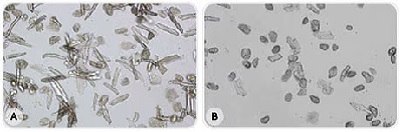 Photomicrographs of isolated cardiomyocytes prepared with water A (A) or water B (B). Images courtesy of Drs. C. Plin and R. Zini, INSERM U660, Créteil School of Medicine, France.  Photomicrographs of isolated cardiomyocytes prepared with freshly purified and ultrafiltered water (A) or stored, ultrapure water without ultrafiltration (B). Many more viable cardiomyocytes were obtained in water A, as shown by their elongated and striated shape.