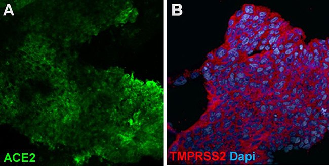 lung-bud-organoids-express-ace-and-tmprss lung-bud-organoids-express-ace-and-tmprss