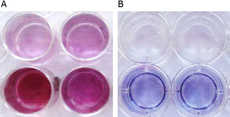 <b>Macroscopic appearance of HOB after mineralization in vitro.</b> A) The negative control in Osteoblast Growth Medium (upper row) is slightly reddish, whereas the mineralized osteoblasts in Osteoblast Mineralization Medium show vast extracellular calcium deposits, stained in bright orange-red (lower row). B) HUVEC (AP negative, upper row) are colorless or faintly bluish, whereas osteoblasts (AP positive, lower row) are dark blue-violet. The higher the AP activity, the more intense the color. Macroscopic appearance of HOB after mineralization in vitro