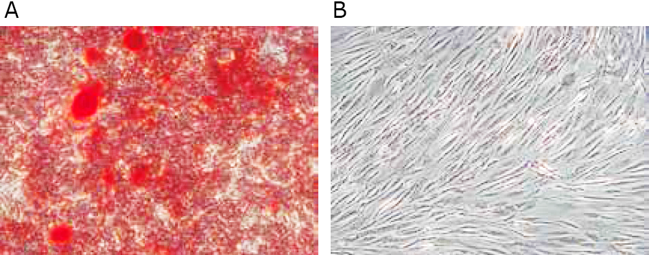 Microscopic appearance of HOB after mineralization in vitro. A) Mineralized osteoblasts in Osteoblast Mineralization Medium show vast extracellular calcium deposits, stained in bright orange-red. Right: The negative control in HOB Growth Medium is slightly reddish. microscopic-appearance-of-hob