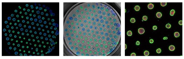 Pancreatic Ductal Adenocarcinoma Organoids (<a href="/product/mm/scc704">SCC704</a>) cultured using Millicell<sup>®</sup> Microwell Plate 400<i>µ</i>m (<a href="/product/mm/mc96u4">MC96U4005</a>). Cells stained with EpCAM (green), Actin (red) and DAPI (blue). Microscopy images of PDAC organoids cultured in Millicell® Microwell plates and stained with EpCAM in green, which surrounds each organoid, action in red, which is in the center of each organoid, and DAPI in blue, which is in the center of each organoid. In the first image, multiple small blue and green circles are in a hexagon grid in the center of a black background. In the second image, multiple small blue and green circles are in a hexagon grid and within slightly larger grey circles, indicating the microwell grid. In the third image, slightly larger green and red circles are spaced evenly on a black background.