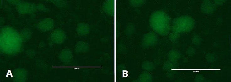 Immunocytochemistry Analysis of mESC colonies. mESC colonies were cultured on 0.1% gelatin coated solid bottom plastic plates with media filtered once (a) or 5 times (b). Colonies were fixed with 3.7% formaldehyde and permeabilized with  0.1% saponin. Expression of Oct-4 was determined with primary anti-Oct-4 antibody followed by visualization with a Cy3 conjugated secondary antibody. Immunocytochemistry Analysis of mESC colonies