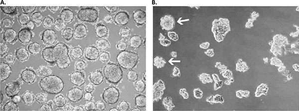 A) The primary isolate was obtained after 4 weeks as a floating sphere-forming culture, which persisted in a near-quiescent state even after 6 months. B) Adding extra growth factors elicited significant expansion in the latent sphere culture with a doubling time of 3-4 weeks. Note that some spheres persisted under these modified culture conditions (white arrows), while the larger part of the culture proliferated as floating planar multicellular 2D sheets, which is a prototypical growth pattern for SCLC cells in vitro. Primary culture derived from a low-grade small cell lung cancer with the Primary Cancer Culture System.