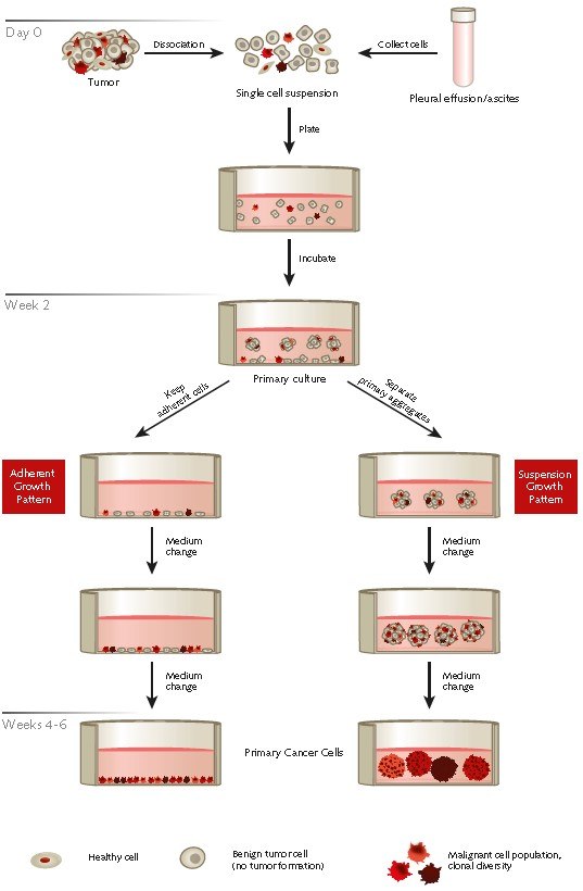 Protocol overview of the selective isolation of primary human cancer cells from patient derived tumor samples or effusions using PromoCell’s Primary Cancer Culture System. Protocol overview of the selective isolation of primary human cancer cells from patient derived tumor samples or effusions using PromoCell’s Primary Cancer Culture System.