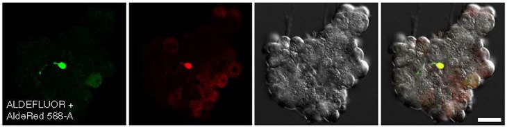 CA/TD murine pancreatic cells co-stained with ALDEFLUOR and AldeRed 588-A CA/TD murine pancreatic cells co-stained with ALDEFLUOR and AldeRed 588-A