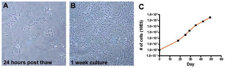 Bright field images of proliferating Human OPCs Bright field images of proliferating Human OPCs