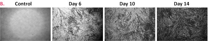 Differentiation of multiple MSC cell lines Differentiation of multiple MSC cell lines