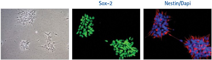 ENStem™-A neural progenitor cells grown for 3 passages in HumanKine® ENStem™-A neural progenitor cells grown for 3 passages in HumanKine®