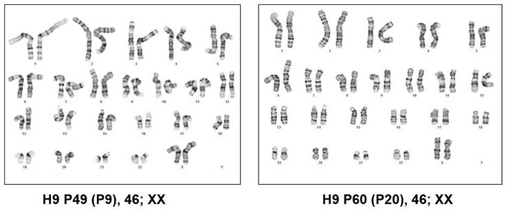 Karyotyping of pluripotent stem cells cultured in PluriSTEM™ media Karyotyping of pluripotent stem cells cultured in PluriSTEM™ media