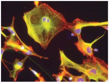 Neural stem cell differentiation Neural stem cell differentiation