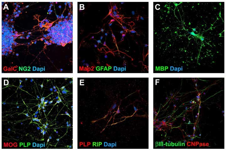 Oligodendrocyte Progenitor Cell Characterization Oligodendrocyte Progenitor Cell Characterization