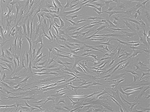 P4 bone-marrow mesenchymal stem cells grown in media containing 10% FBS P4 bone-marrow mesenchymal stem cells grown in media containing 10% FBS