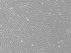 P4 bone-marrow mesenchymal stem cells P4 bone-marrow mesenchymal stem cells