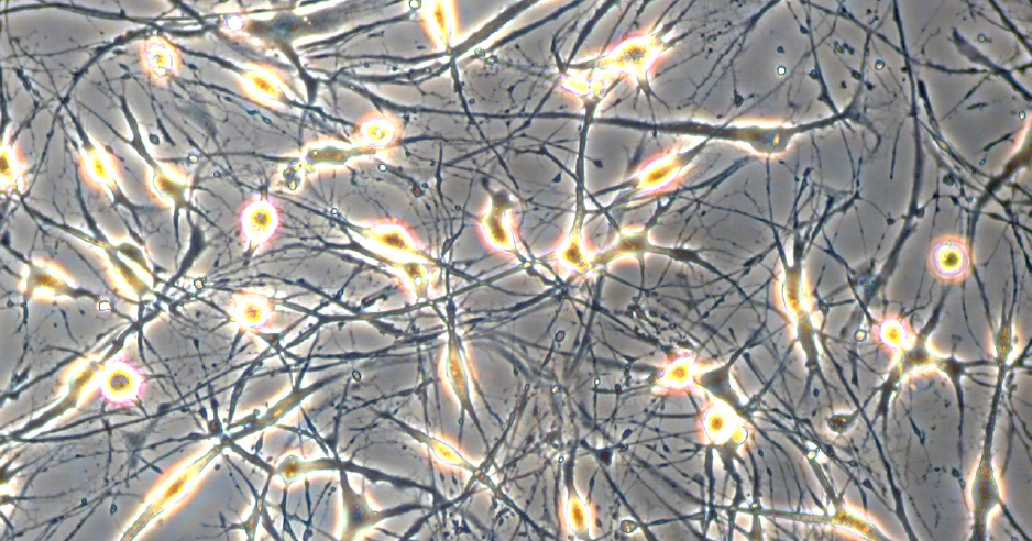 Neuron-like cells generated from human bone marrow derived mesenchymal stem cells in PromoCell’s MSC Neurogenic Differentiation Medium (<a href="/product/sigma/C28015">C-28015</a>). Note the formation of axon- and dendrite-like cellular structures. Neural differentiation of human MSCs.