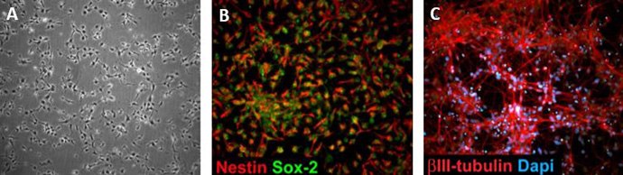 Human iPSC derived neural stem cells Human iPSC derived neural stem cells