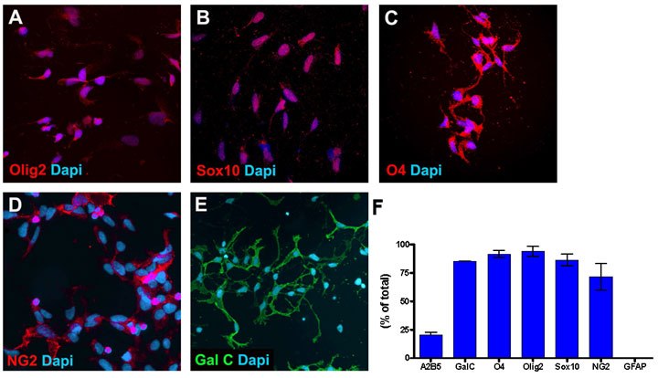 Oligodendrocyte Progenitor Cell Characterization Oligodendrocyte Progenitor Cell Characterization
