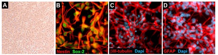 ReNcell VM Human Neural Progenitors ReNcell VM Human Neural Progenitors
