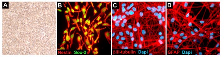 ReNcell CX Human Neural Progenitors ReNcell CX Human Neural Progenitors