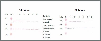 Western blot. Western blot.