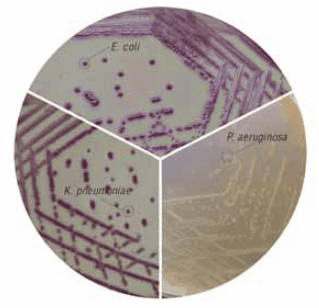 HiCrome™ ECC Agar (73009) HiCrome™ ECC Agar (73009)