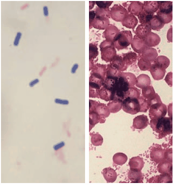 Gram staining (on the left Gram-positive Bacilus cereus, on the right Gram-negative Citrobacter). Gram staining (on the left Gram-positive Bacilus cereus, on the right Gram-negative Citrobacter).