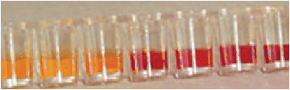 ß- Lactamase Test kit (positive reaction is shown by a color change to yellow) ß- Lactamase Test kit (positive reaction is shown by a color change to yellow)