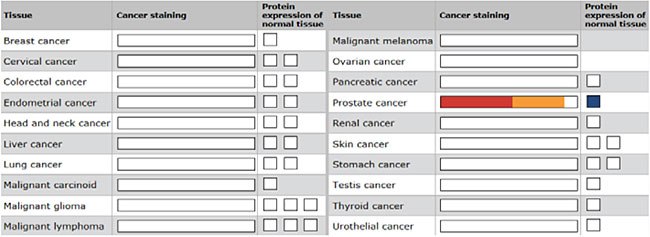Example of antibody staining data in a range of cancer tpes Example of antibody staining data in a range of cancer types