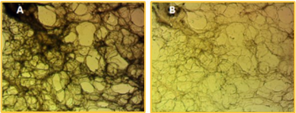 Precision cut lung slice before (left) and after (right) subjected to tissue clearing by Visikol method HepG2 spheroids stained with Calcein AM, DAPI, and PI. Precision cut lung slice before (left) and after (right) subjected