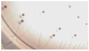 Yogurt sample cultured on BSM Agar. Bifidobacteria appears as purple-brown colonies. Yogurt sample cultured on BSM Agar. Bifidobacteria appears as purple-brown colonies.