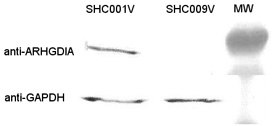 Human Positive, ARHGDIA shRNA Human Positive Control #2, ARHGDIA shRNA
