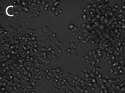 eGFP shRNA-Bright field illumination eGFP shRNA