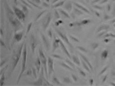 Cell growth after puromycin selection for four days - Infected with Virus  Cell growth after puromycin selection for four days - Infected with Virus