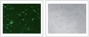 X-tremeGENE™ HP Reagent efficiently transfects human primary fibroblasts. X-tremeGENE™ HP Reagent efficiently transfects human primary fibroblasts