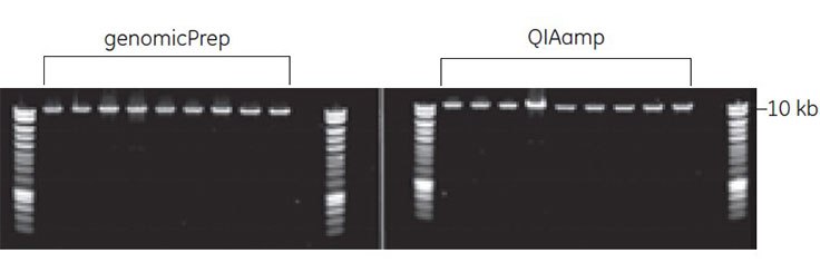 Amplification of an 11 kb amplicon from purified bacterial genomic DNA Amplification of an 11 kb amplicon from purified bacterial genomic DNA