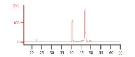 Electropherogram of total RNA Electropherogram of total RNA