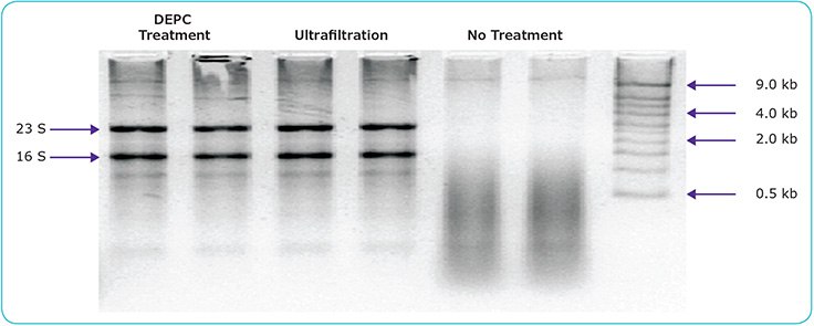 Gel electrophoresis of rRNA in water previously spiked with RNase and either DEPC-treated, ultrafiltered, or left untreated. Gel electrophoresis of rRNA in water previously spiked with RNase and either DEPC-treated, ultrafiltered, or left untreated