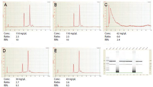 Agilent 2100 BioAnalyzer Analysis of RNA Samples A–E Agilent 2100 BioAnalyzer Analysis of RNA Samples A–E