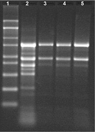 Total RNA extracted from 100 mg of Jatropha tissue Total RNA extracted from 100 mg of Jatropha tissue