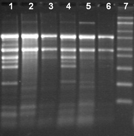 Total RNA Isolation from different tissue types of tobacco using the Spectrum™ Total RNA kit Total RNA Isolation from different tissue types of tobacco using the Spectrum™ Total RNA kit