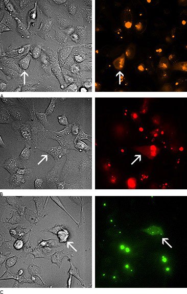 Microscopic images of treatment cells.  Microscopic images of treatment cells.